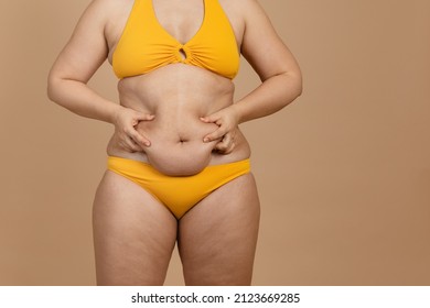 Cropped image of overweight fat naked woman with obesity, excess fat in yellow swimsuit. Big size. Holding stomach flabs, visceral, cellulite. Self acceptance, body positive, plus size, friable skin