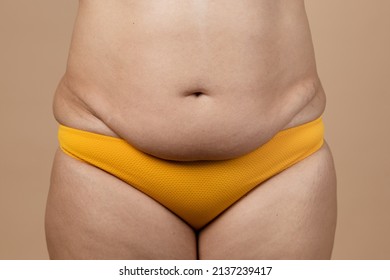 Cropped image of overweight fat pregnant woman sag stomach with obesity, excess fat in yellow pants. Fast weight loss. Stomach flabs. Dehydrated, flabby skin swelling, losing turgor collagen. Surgery