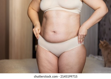 Cropped image overweight fat woman stomach with obesity, excess fat in shape underwear. Arms pulling, hiding big excessive belly with navel. Stomach flabs with friable skin, visceral fat. Close up