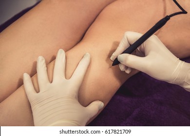 Cropped image of woman legs getting the laser epilation