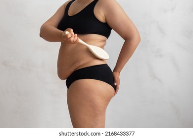 Cropped overweight, adipose female rubbing fold back, side skin, using stiff exfoliating brush, anti cellulite dry lymph massage against visceral excess fat. Spa procedure. Health, body care, beauty