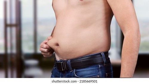 Cropped Of Overweight Fat Man Holding Tummy Flabs With Obesity. Inclination Body. Adipose Stomach. Big Size.