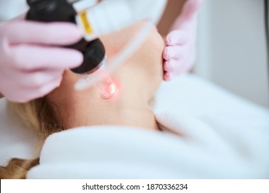 Cropped photo of a qualified dermatologist in latex gloves performing a fractional laser resurfacing procedure - Shutterstock ID 1870336234