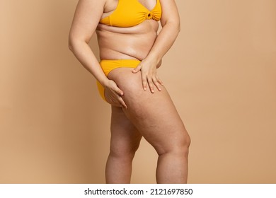Cropped photo of woman body excess orange skin in yellow swimsuit, treatment of obesity cellulite on hips, buttocks. Overweight fat folds hanging. Big size. Holding flabs. Varicose veins, massage