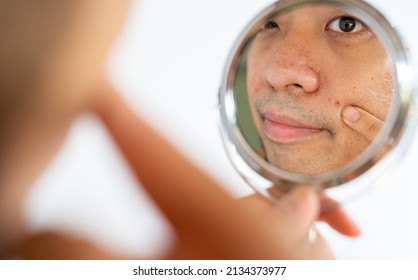 Cropped shot of Asian man saw the problem of pimple or acne on his face by a mini mirror. Conceptual shot of Acne and problem skin on male face.