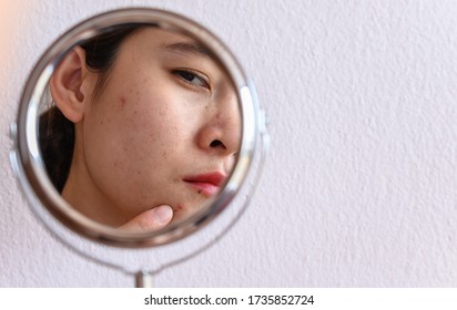 Cropped shot of Asian woman worry about her face when she saw the problem of acne and scar by the mini mirror. Conceptual shot of Acne & Problem Skin on female face.