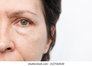 Cropped shot of an elderly caucasian woman's face with puffiness under her eyes and wrinkles isolated on a white background. Age-related skin changes, fatigue. Cosmetology and beauty concept