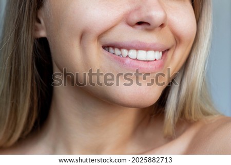Cropped shot of a face of a young caucasian smiling blonde woman with dimples on her cheeks. Close-up of a blonde girl with even white teeth. Dentistry