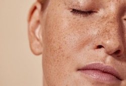 Cropped Shot Of The Face Of A Young Woman With Freckles
