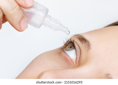 Cropped Shot Of Woman Dripping Her Eyes With Medicinal Drops Natural Tear. Disease Of Eye Retina. Conjunctivitis, Keratitis, Dry Eye Syndrome, Trauma. Treatment Of Red Inflamed Capillaries