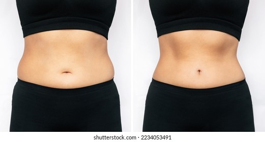 Cropped shot of a woman with excess fat and toned slim stomach before and after losing weight isolated on a white background. Result of diet, liposuction, training. Healthy lifestyle, wellness