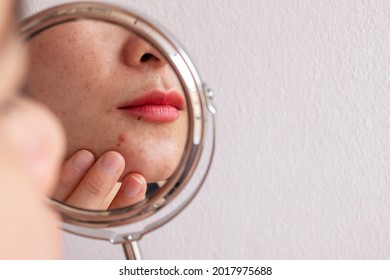 Cropped shot of woman worry about her face when she saw the problem of acne occur on her chin by a mini mirror. Conceptual shot of Acne and problem skin on female face.