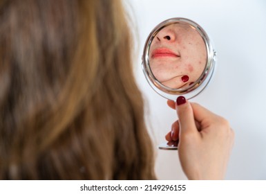 Cropped shot of woman worry about her face when she saw the problem of acne occur on face by a mini mirror. Conceptual shot of Acne and problem skin on female face.