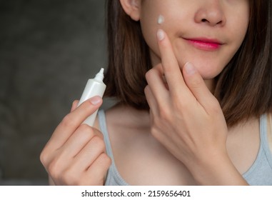 Cropped Shot Young Asian Woman Holding Cosmetic Tube And Applying Acne Cream Or Moisturizer On Her Face For Treat Her Skin. Conceptual Of Beauty And Cosmetic.