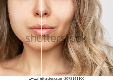 Cropped shot of young caucasian blonde woman with wavy hair before and after plastic surgery buccal fat pad removal. A lower part of face with clear highlighted cheekbones. Result of cosmetic surgery