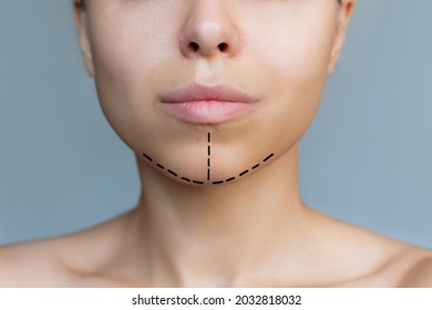 Cropped Shot Of A Young Caucasian Woman With Marking On Her Chin On A Gray Background. Facial Plastic Surgery Concept