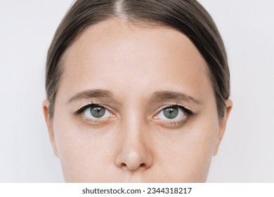 Cropped shot of a young caucasian woman's face with drooping upper eyelids isolated on a white background 