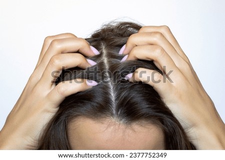 Cropped shot of a young woman scratching her head with her fingers and nails, isolated on a white background. Scalp diseases: fungus, dandruff, seborrhea, psoriasis, rash. Hair loss. Itching. Close-up