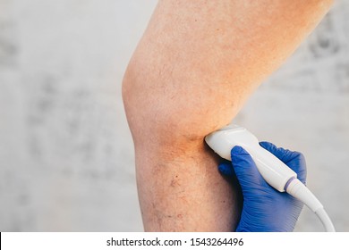 Cropped Ultrasound Exam Veins On The Leg, Vein Thrombosis, Varicose Veins