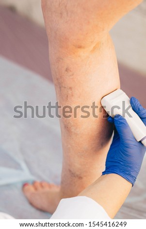 cropped ultrasound exam veins on the leg, vein thrombosis, varicose veins