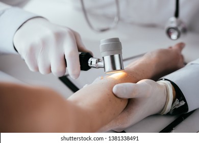 cropped view of dermatologist examining hand of woman while holding dermatoscope 