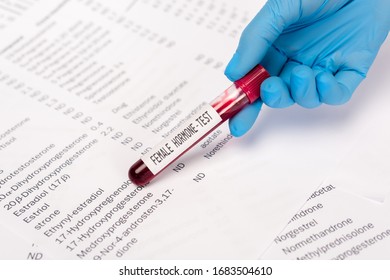 Cropped view of doctor holding test tube with sample of female hormone near lists with hormones