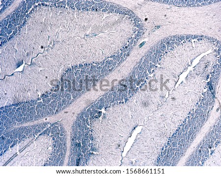 Cross section of a cerebellum. Light micrograph. Cresyl Violet Staining (Nissl Staining).