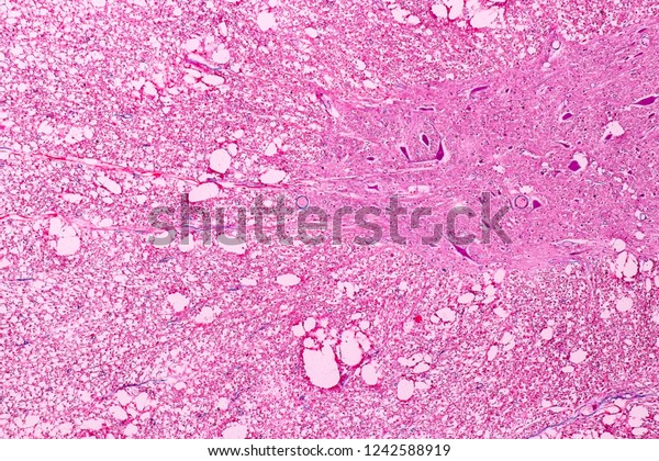 Cross Section Cerebellum Nerve Human Under Stock Photo 1242588919 ...