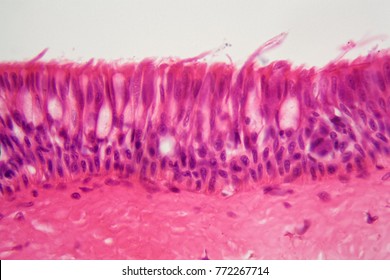 A cross section of ciliated epithelium under the microscope.