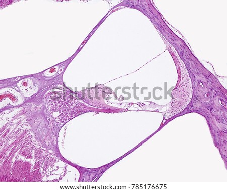 Cross section of the cochlea. The cochlear duct shows, from left to right, the spiral ganglion, tectorial membrane, Organ of Corti and stria vascularis. 