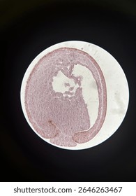 Cross section of an earthworm 