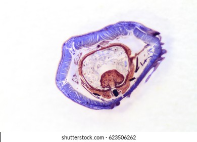 Cross section of an earthworm.
