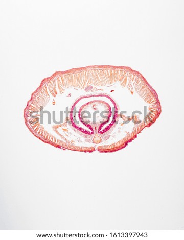 Cross section of an earthworm.