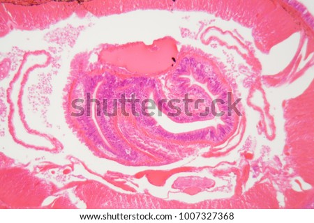 Cross section of an Earthworm under the microscope.