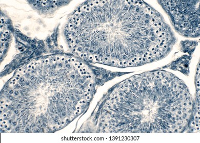 357 Cross section of the testis Images, Stock Photos & Vectors ...