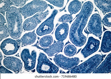 Cross section Human testis under microscope view. Shows spermatogonia, spermatocytes in meiosis, spermatids, and spermatozoa