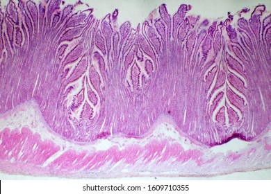 21 Submucosa Muscularis Externa Images, Stock Photos & Vectors ...