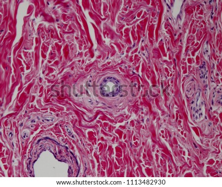 Cross section of intradermal portion of excretory duct of an eccrine sweat gland, lined by a stratified epithelium formed by two layers of cuboidal cells. 