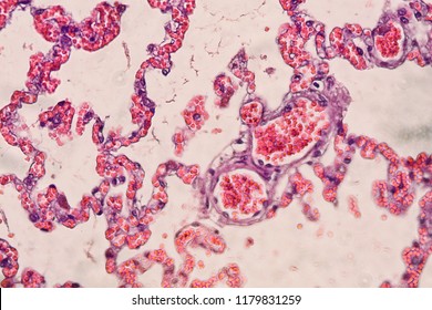 Cross Section Lung Tissue Hematoxilin Eosin Stock Photo 1179831259 ...