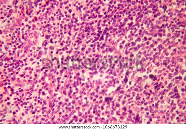 Cross Section Lymph Node Under Microscope Stock Photo 1066673129 ...