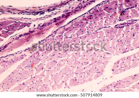 Cross section of Muscle Skeletal under the microscope
