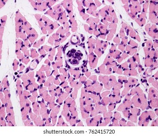 Cross Section Of A Muscle Spindle Stained With Hematoxylin Eosin, Located In A Young Muscle. It Is Surrounded By A Capsule And Includes Fibers With Nuclear Bag And Nuclear Chain Fibers.