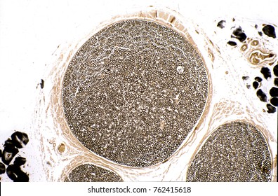 Cross Section Of A Nerve Fascicle Fixed In Osmium Tetroxide. Each Small Black Circle Inside The Fascicle Corresponds To A Myelinated Nerve Fiber.

