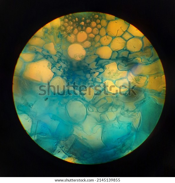 a cross section of a plant, where the cells\
are blue, under the microscope. The single cells and a half\
vascular bundle can be\
recognized