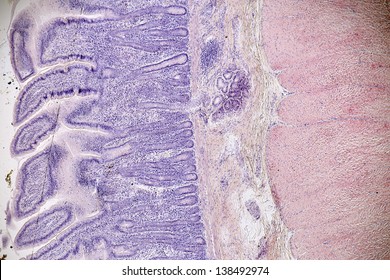 306 Cross section small intestine Images, Stock Photos & Vectors ...