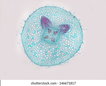 Cross Section Of A Soybean (Glycine Max) Root Showing Developing Root Nodule.  Magnification 40x 