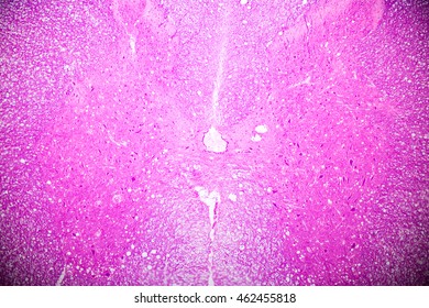 Cross Section Spinal Cord Stock Photo 462455818 | Shutterstock