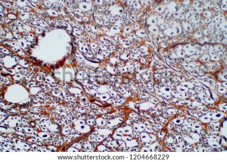 Cross section of spinal cord under the microscope view. Histological for human physiology.