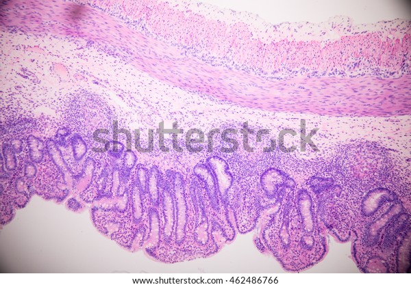 Cross Section Stomach Tissue Microscopic View Stock Photo 462486766 ...