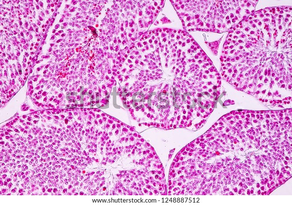 Cross Section Testis Tissue Under Microscope Stock Photo (Edit Now ...